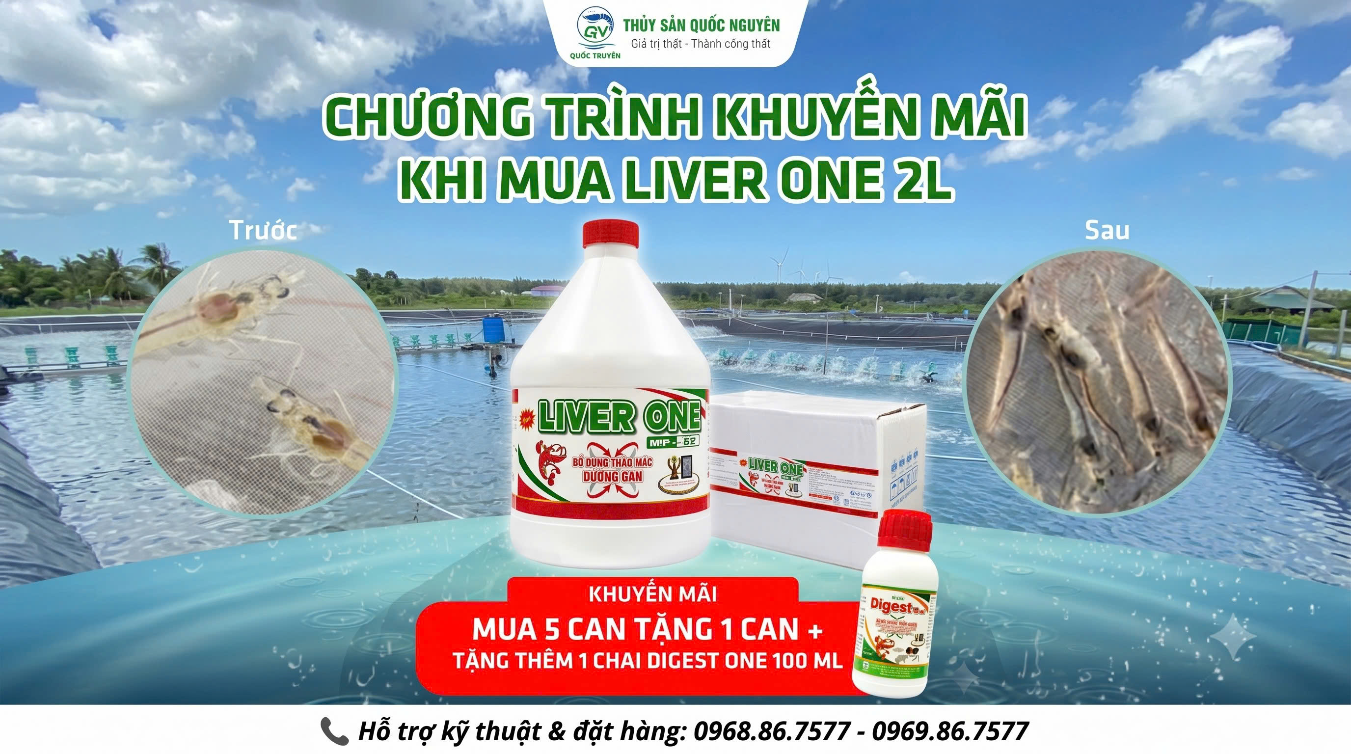 MUA 5 TẶNG 2 KHI MUA LIVER ONE 2L